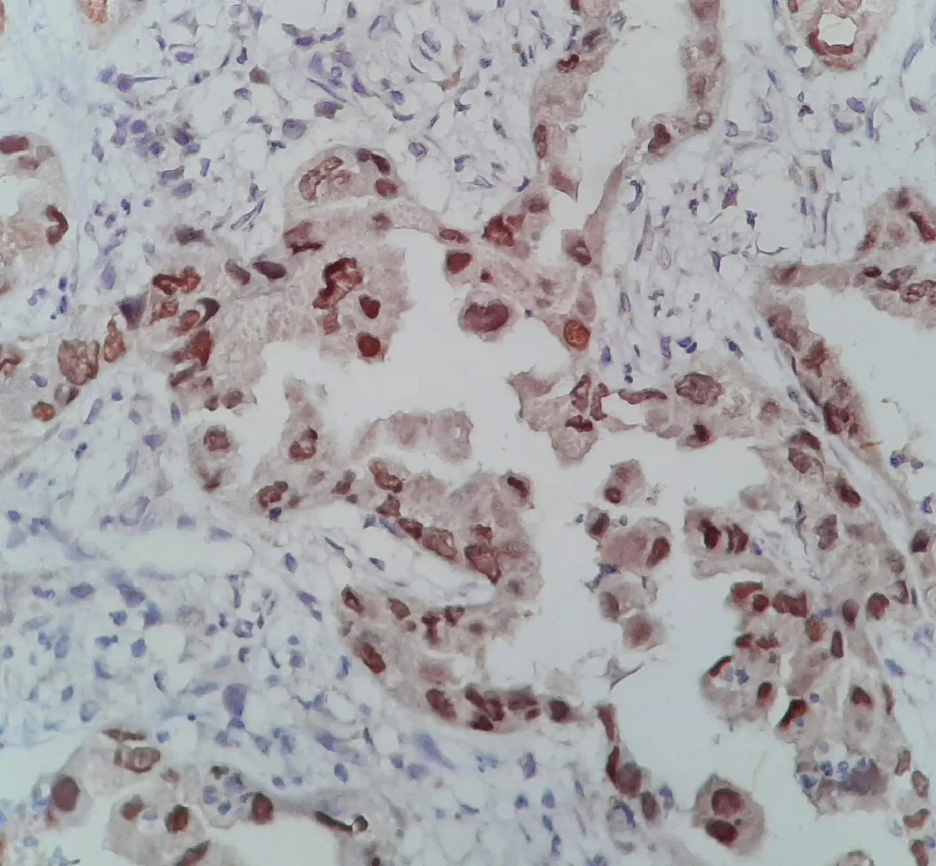 Carrusel de Patología - Imagen 4