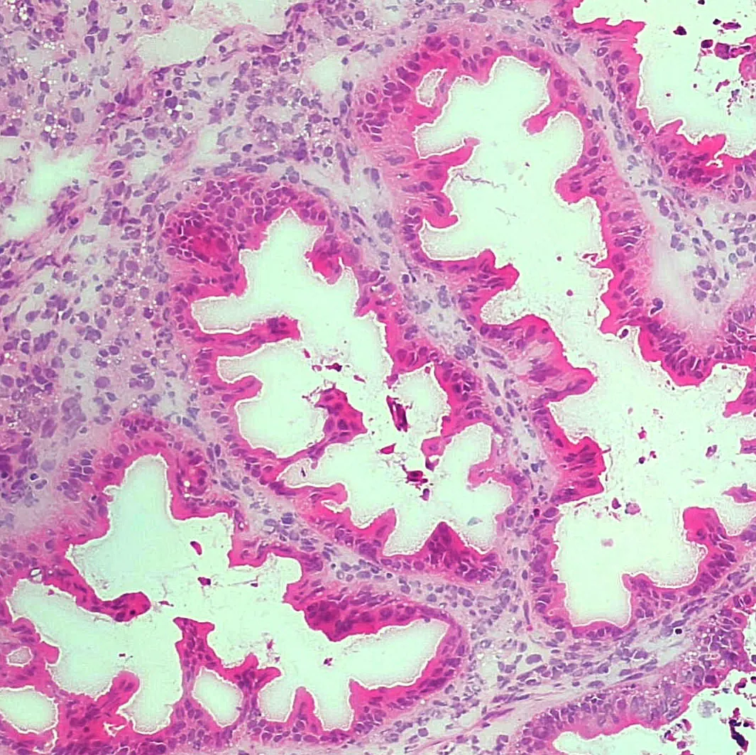 Carrusel de Patología - Imagen 1